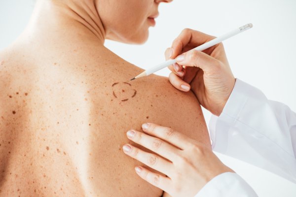 Dermatology_AdobeStock_264439520.jpeg