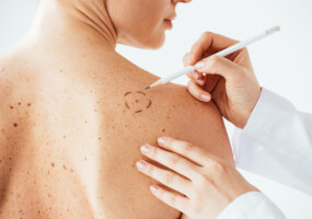Dermatologist