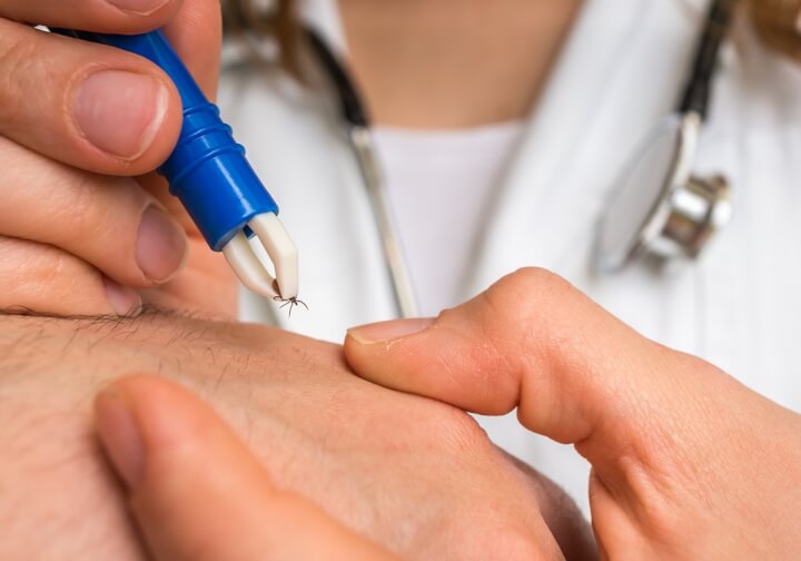 Found a tick on yourself? We'll give you advice on when to see a doctor