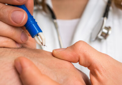 Found a tick on yourself? We'll give you advice on when to see a doctor